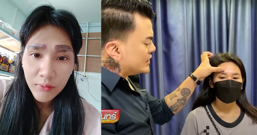 su co xam long may anh 1