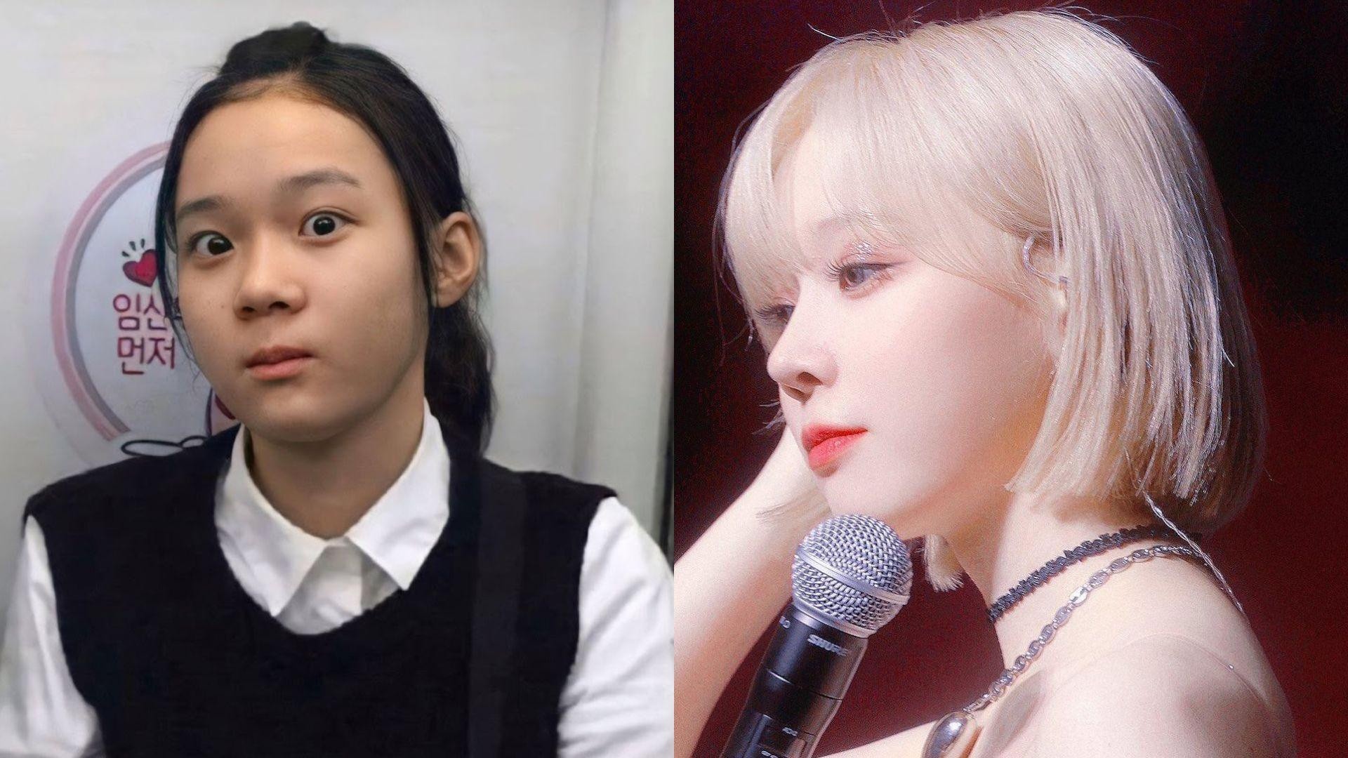 Vi sao nhieu nguoi am anh voi viec sua, nang mui hinh anh