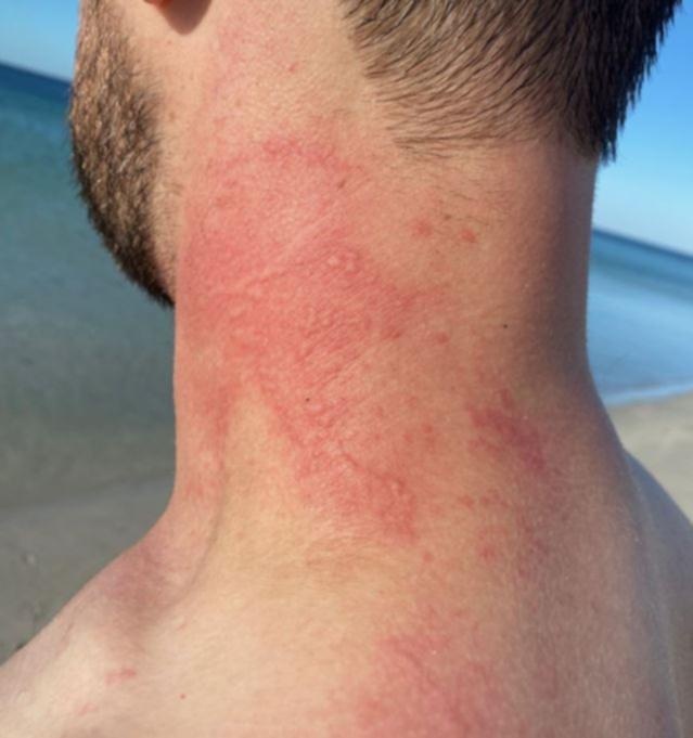 Nha dia chat bi 'bach tuoc gian giu nhat' tan cong anh 2