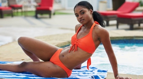 Thi sinh Hoa hau My 2018 lo nhuoc diem hinh the voi bikini hinh anh