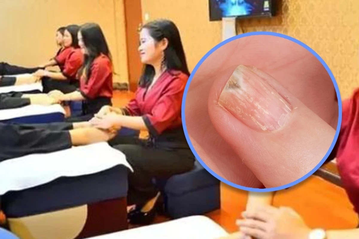 Be trai 4 tuoi mat ngon tay vi di tri benh o tiem massage chan hinh anh