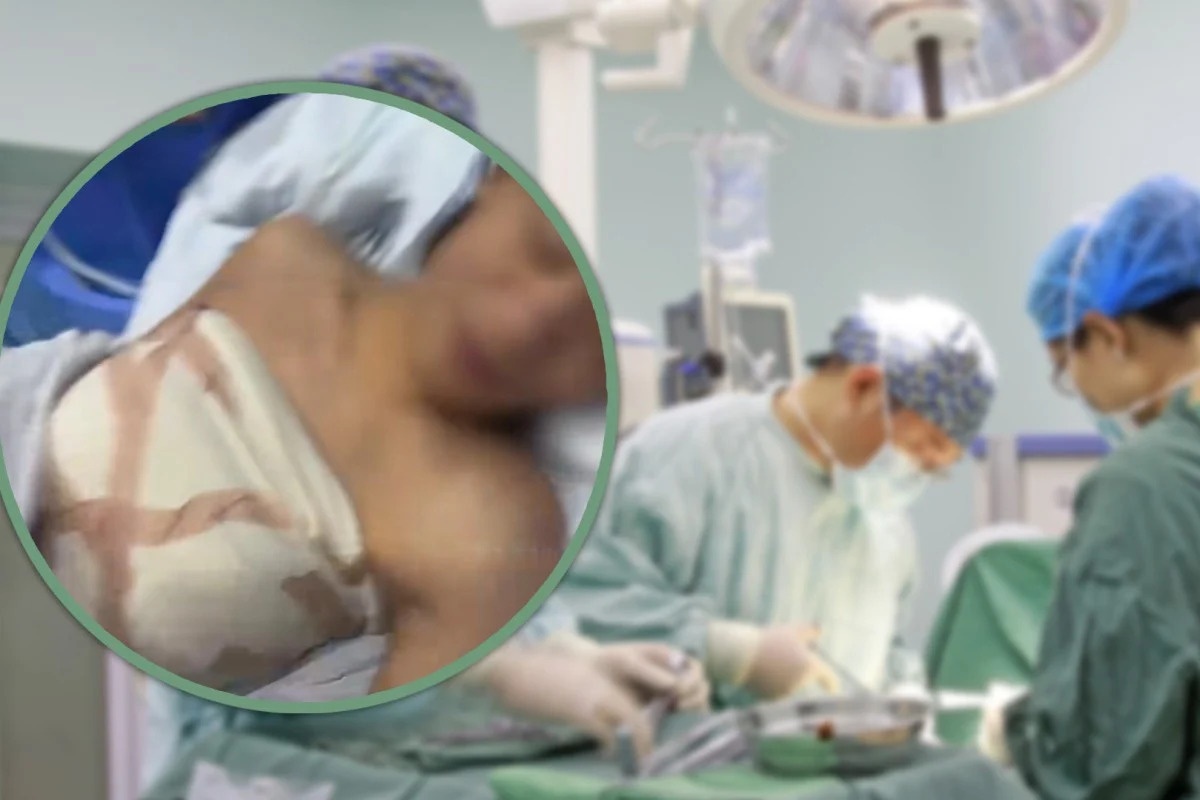 Chang trai bi lua phau thuat nang nguc o Trung Quoc hinh anh