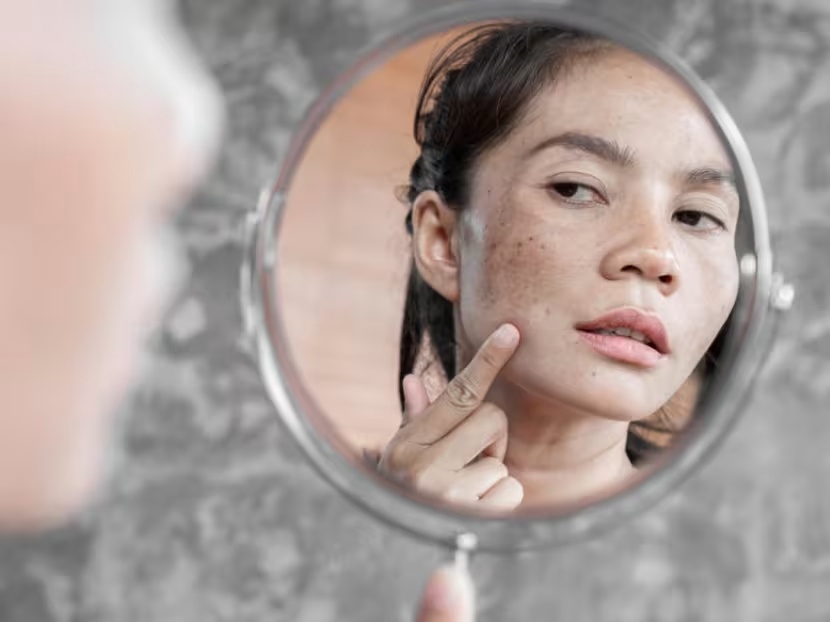 Cach su dung vitamin C de xoa vet tham, lam deu mau da hinh anh