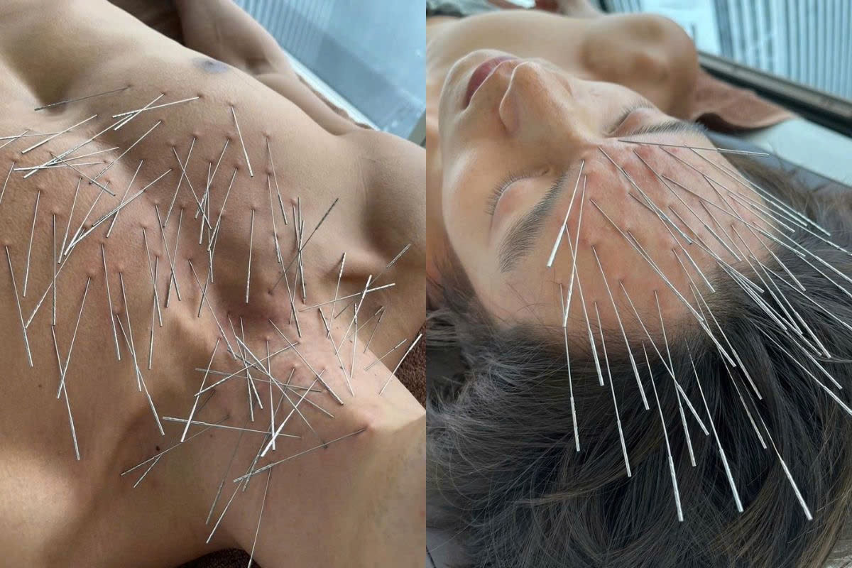 Buc anh cham cuu khien Instagram phai canh bao hinh anh