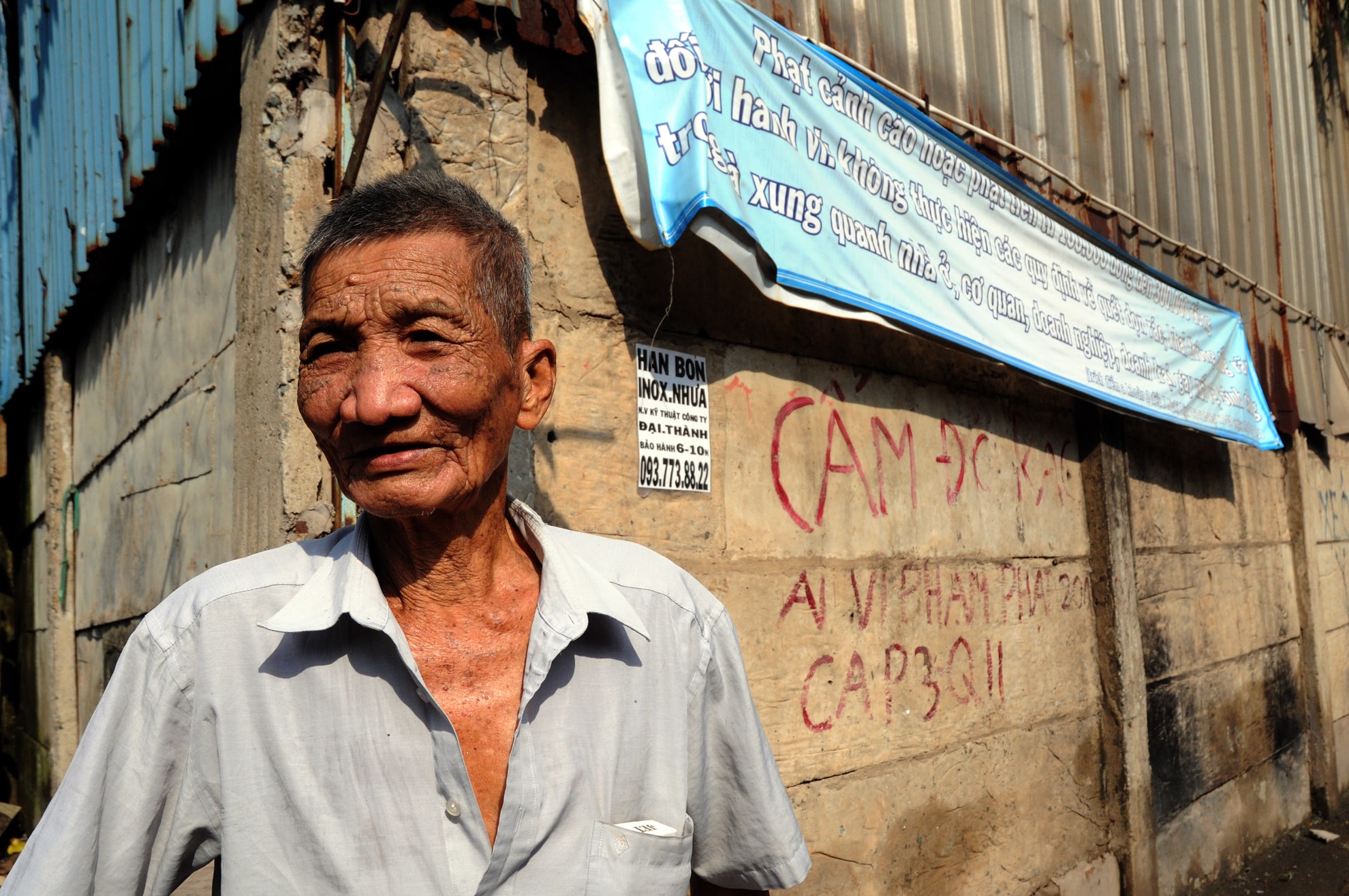 Cũng may là thịt ông lành, nên chỉ vài bữa vết thương tự lành để ông tiếp tục công việc của mình.