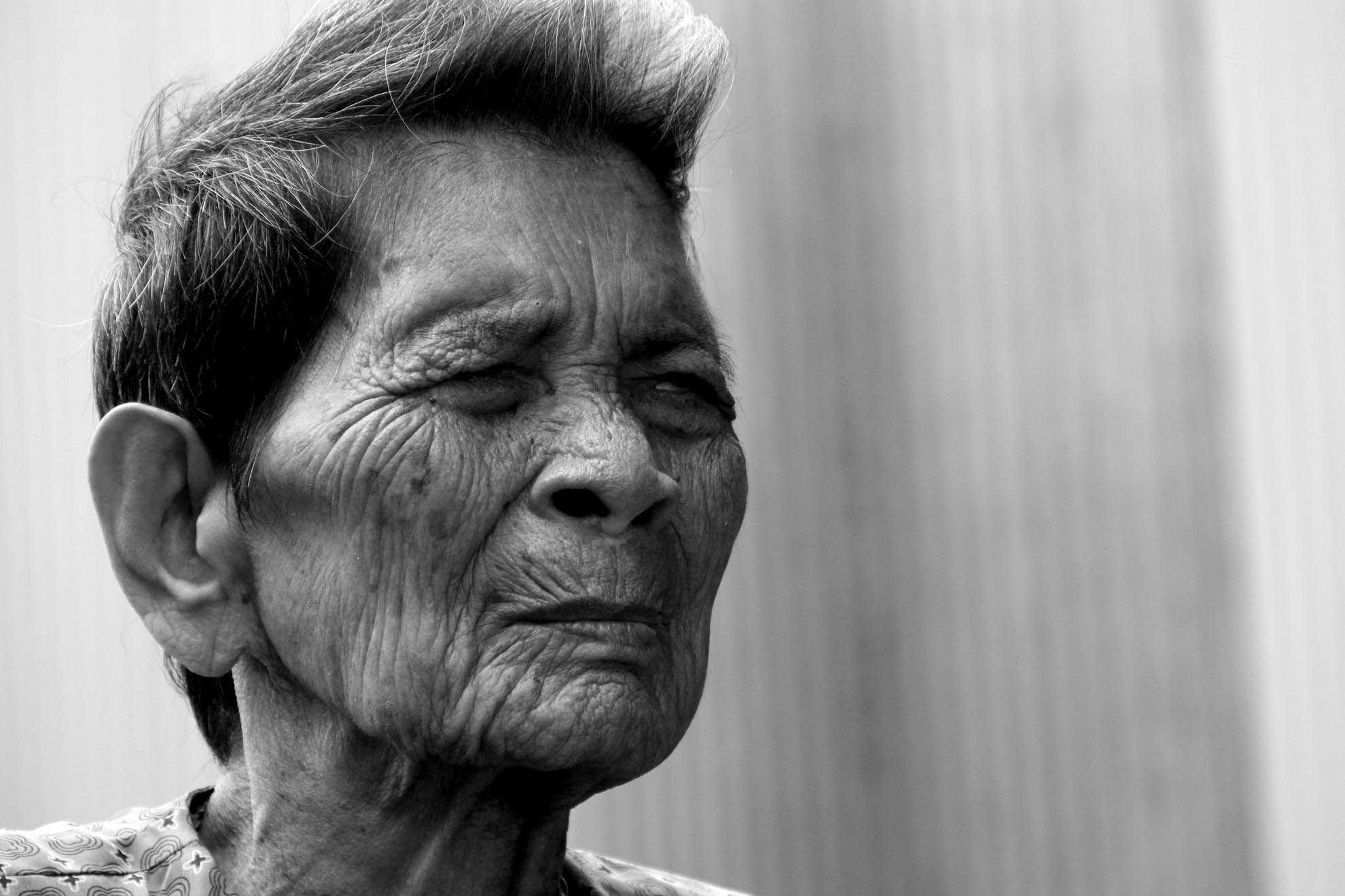 Theo gia đình thì không phải do làm hành mà do khi đi biển bị gió cát thổi đau mắt thường lấy tay dụi, lâu ngày bị xướt giác mạc, mà lại không biết cách chữa trị dẫn đến mù vĩnh viễn.