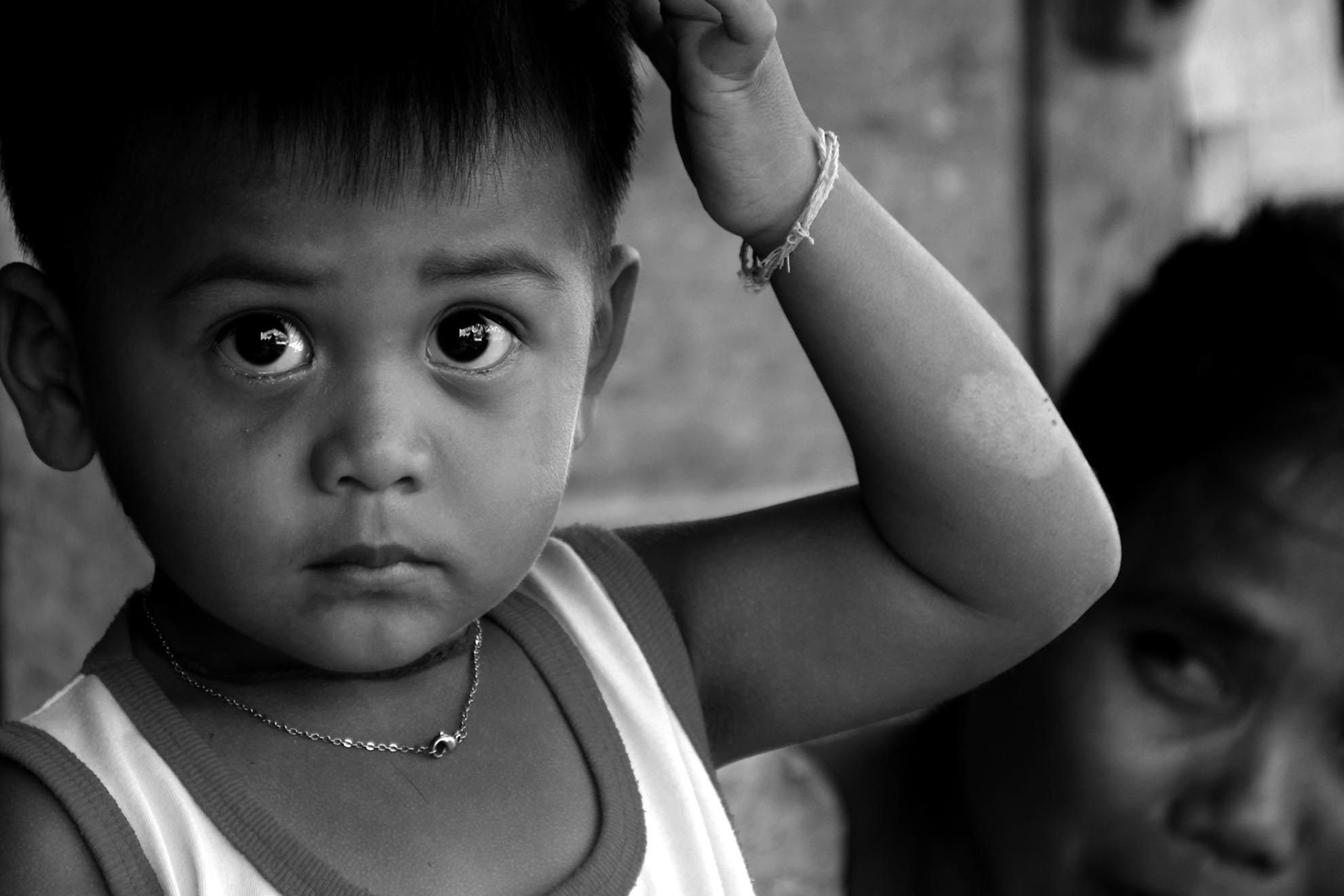 Dù không thể khẳng định tuyệt đối, hành là nguyên nhân song không thể phủ nhận đây là yếu tố lớn nhất làm cho mắt dễ bị tổn thương và gây mù. Bên cạnh đó sự thiếu kiến thức nên việc bảo vệ mắt cũng như sự vô tâm của gia đình khiến cho trẻ thơ là nạn nhân của thảm họa này. Vì thế chính quyền cần có các biện pháp tuyên truyền hỗ trợ tốt hơn để cuộc sống trong bóng tối không còn ám ảnh người dân Đại Bái