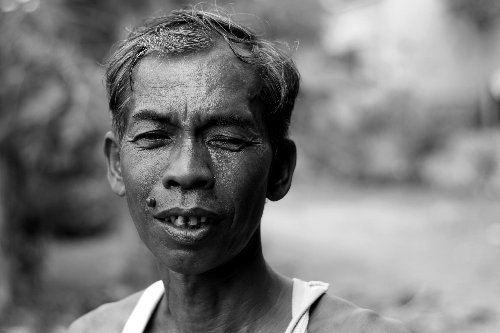 Khi con trẻ ông Thom là một thanh niên khỏe mạnh và đi làm hành thuê cho người khác. Sau một thời gian dài mắt ông cũng bị lòa và cuối cùng phải múc bỏ một mắt.