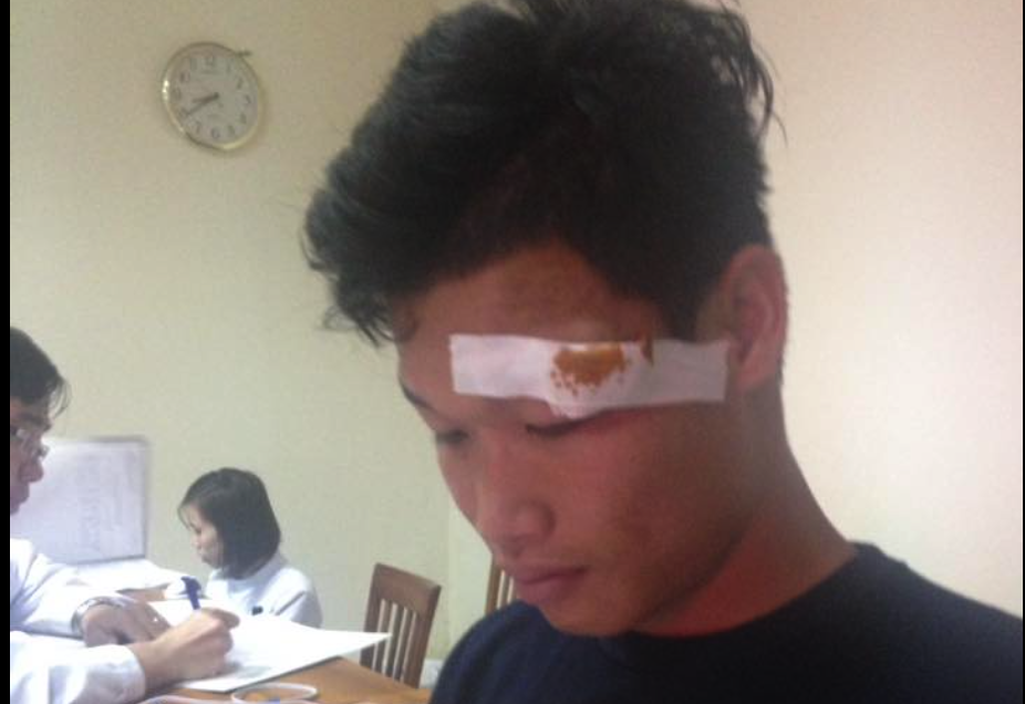 Dong Trieu rach mi mat, bo do tran dau gap Quang Nam hinh anh