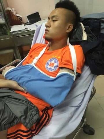 Huy toàn gãy tay trước mùa giải 2017 ảnh 2 Huy toan gay tay truoc mua giai 2017 anh 2