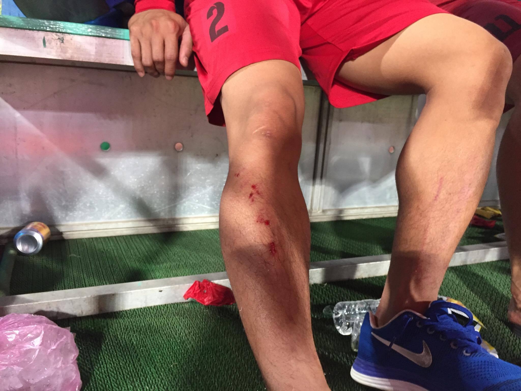 CDV Hai Phong khien My Dinh that thu anh 10