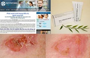 Ảnh 1, 2: Sản phẩm R47-Protumol và những lời quảng cáo “có cánh” này làm không ít bệnh nhân ung thư bị sụp bẫy. Ảnh 3: Với một số hình ảnh đơn giản này công ty “nổ” là trị được ung thư. Ảnh: TÙNG SƠN