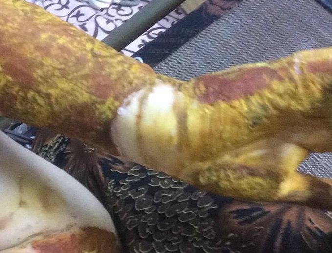 Vu nu sinh bi bong: 'Nha truong xu ly qua cham' hinh anh