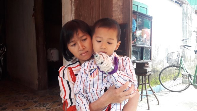 cô giáo đánh gãy ngón tay học sinh ảnh 1 co giao danh gay ngon tay hoc sinh anh 1