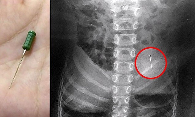 Ep ban nuot kim va canh bao nguy co tu bao luc hoc duong hinh anh