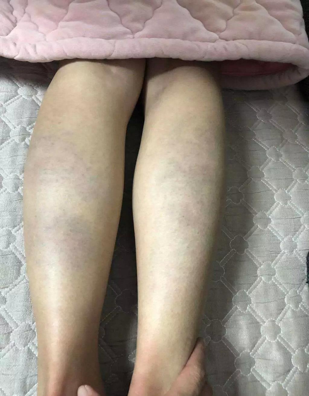 giáo viên đánh học sinh ảnh 1 giao vien danh hoc sinh anh 1