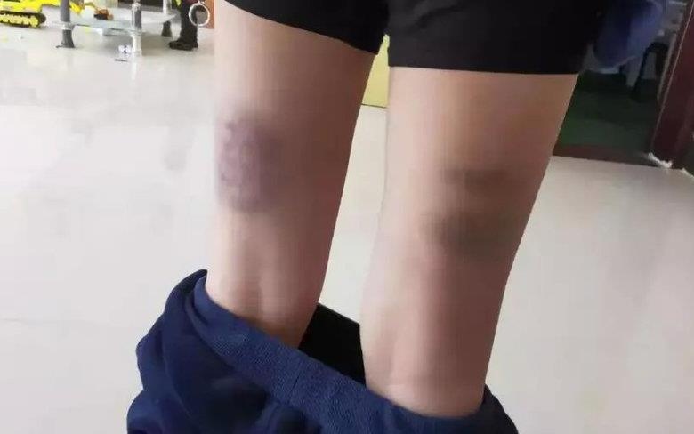Dat diem kem, hoc sinh bi co giao danh den 840 cai hinh anh