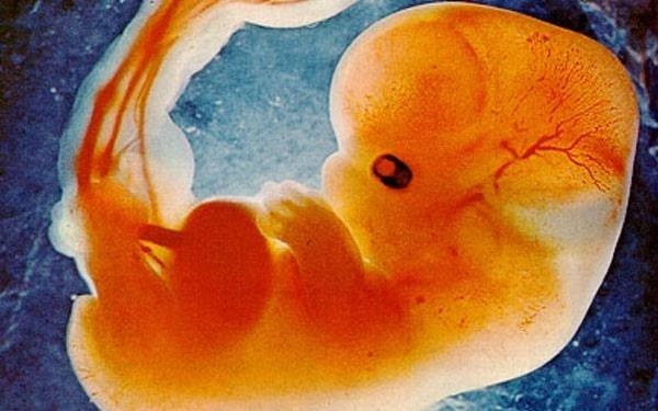 Giao su bi chi trich gay gat vi goi bao thai la ky sinh trung hinh anh