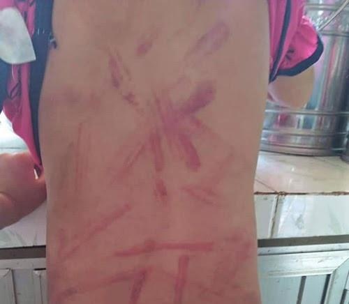 Ba danh chau gai 6 tuoi bam tim nguoi hinh anh