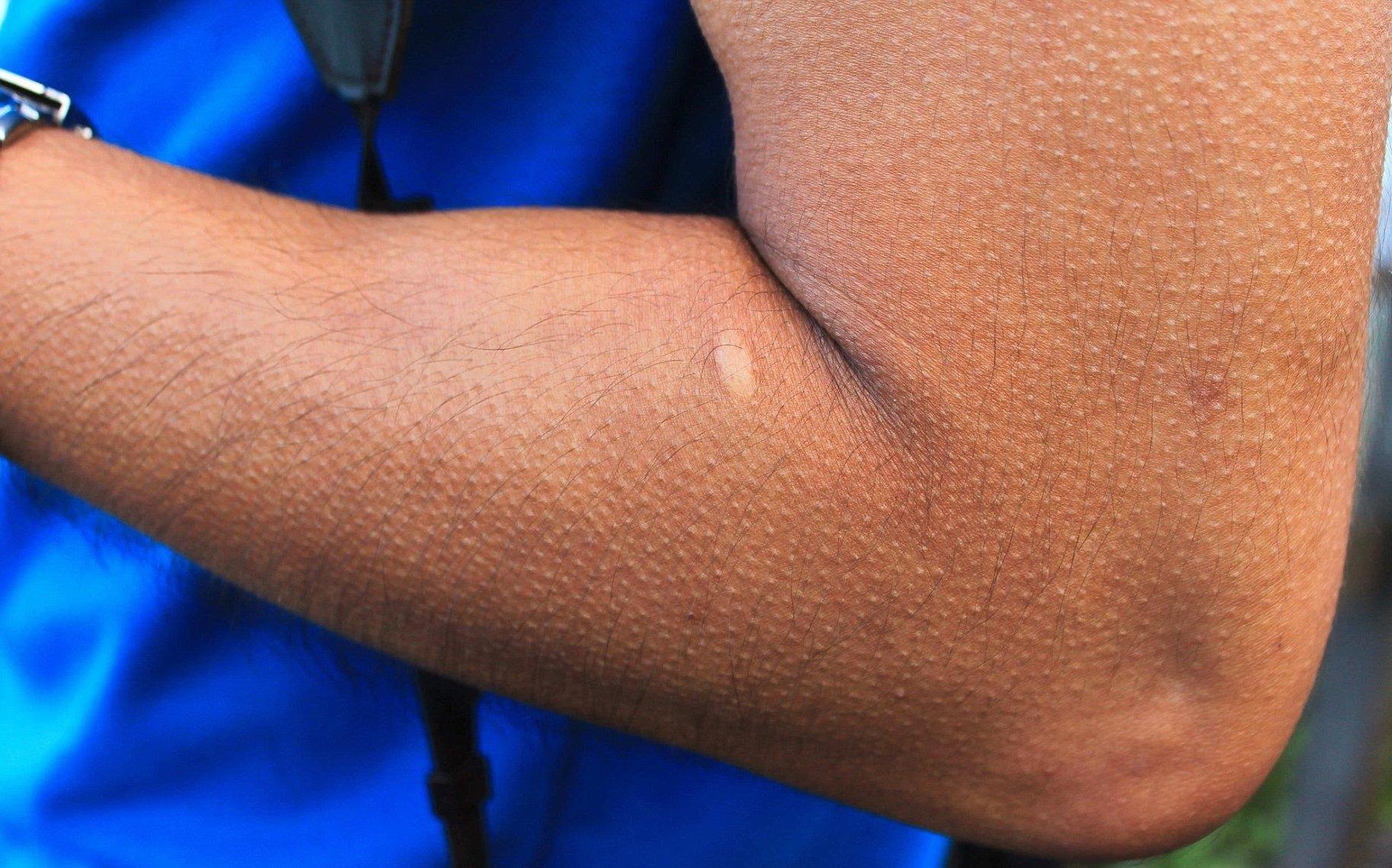 Vi sao co the noi da ga, co tac dung gi? hinh anh