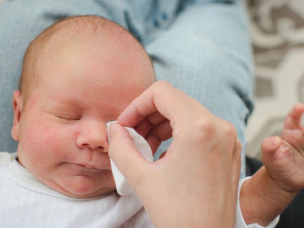 nổi da gà ảnh 5 noi da ga anh 5