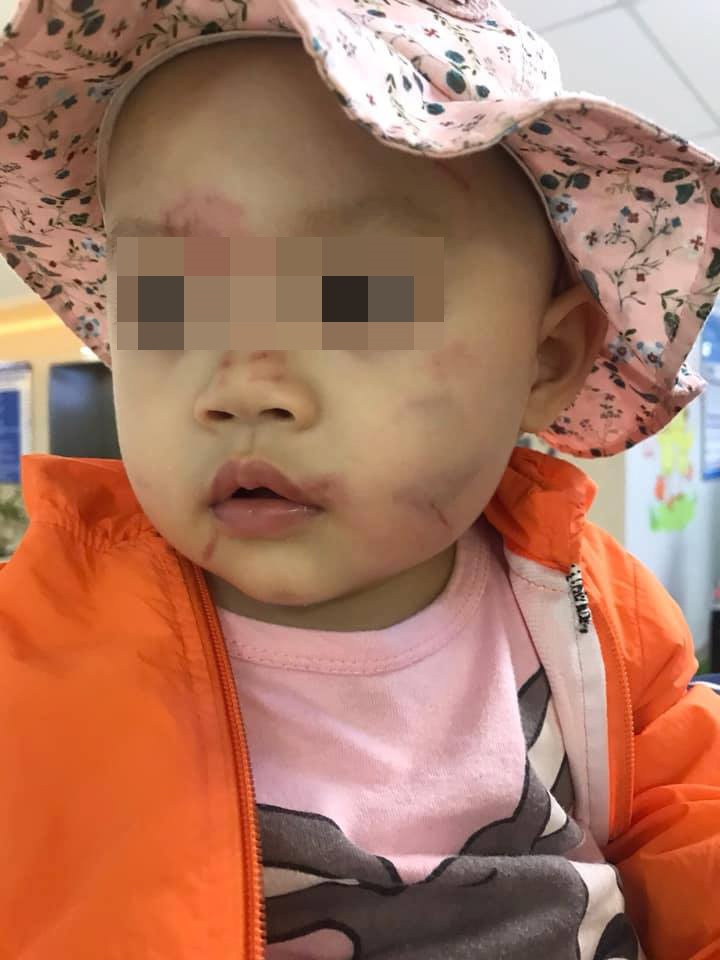 Be 14 thang tuoi bam tim mat anh 1