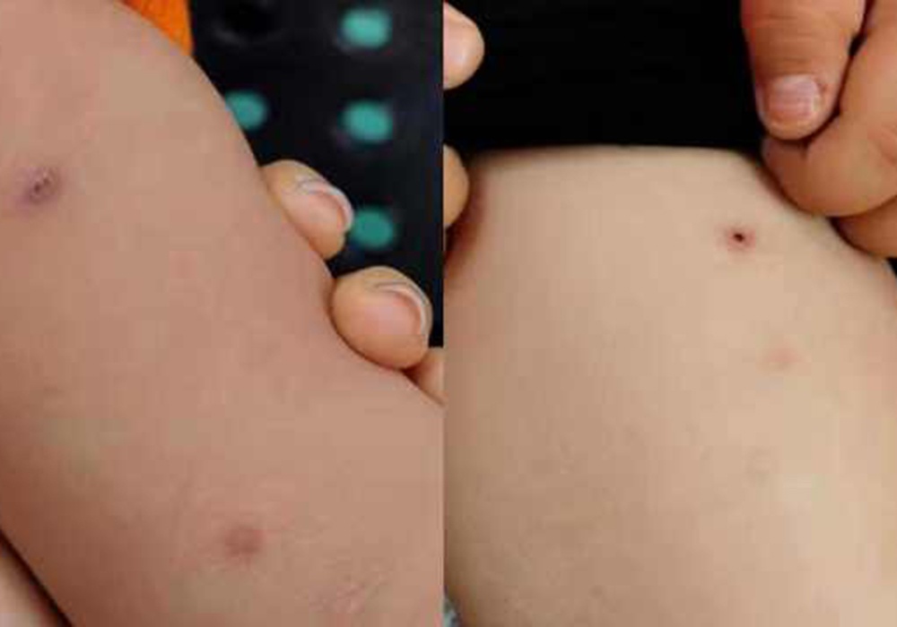 3 giao vien mam non bi to dung kim dam tre hinh anh