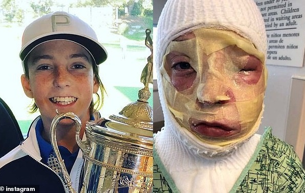 nam sinh bong nang vi su co anh 1