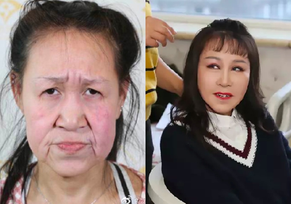 Thiếu nữ trông như bà lão ảnh 1 Thieu nu trong nhu ba lao anh 1
