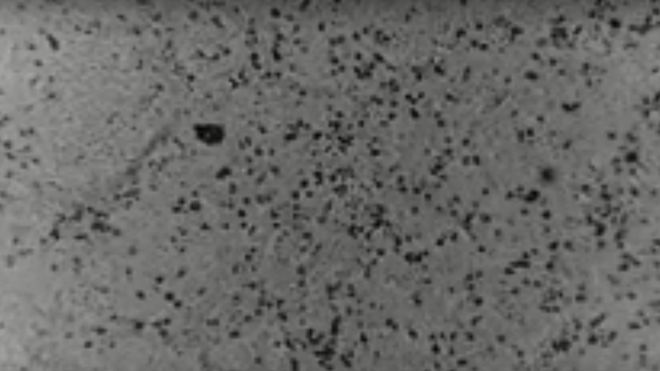 hinh anh dau tien cua virus corona anh 1