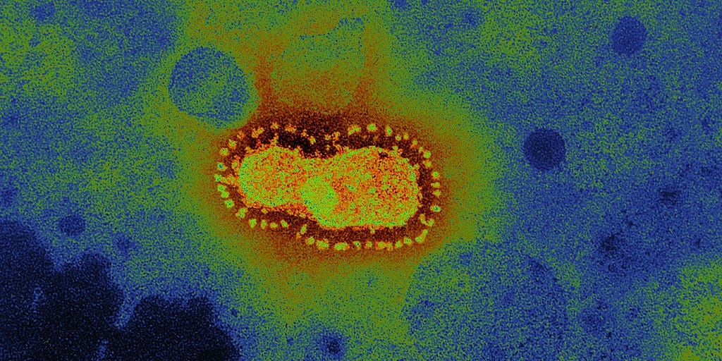 hinh anh dau tien cua virus corona anh 2