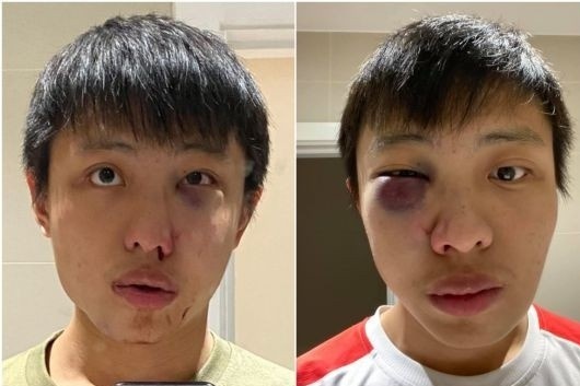 Du hoc sinh o Anh bi danh va ky thi vi virus corona hinh anh