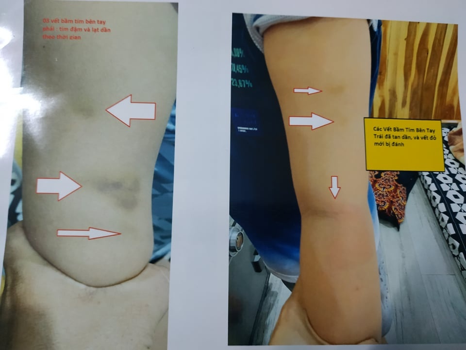 To co giao danh tre anh 1