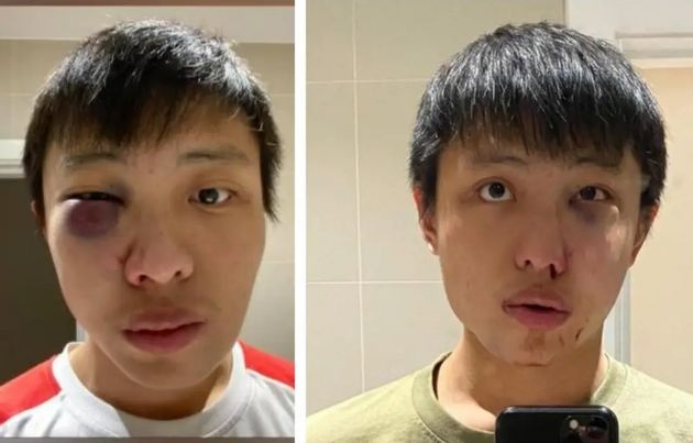 đánh du học sinh người châu Á ảnh 1 danh du hoc sinh nguoi chau A anh 1