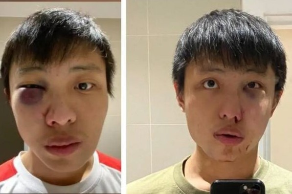 Thieu nien Anh hau toa vi danh du hoc sinh nguoi chau A hinh anh