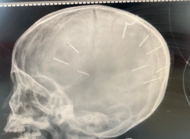 Noi lo tre bi bao hanh trong chinh ngoi nha cua minh hinh anh