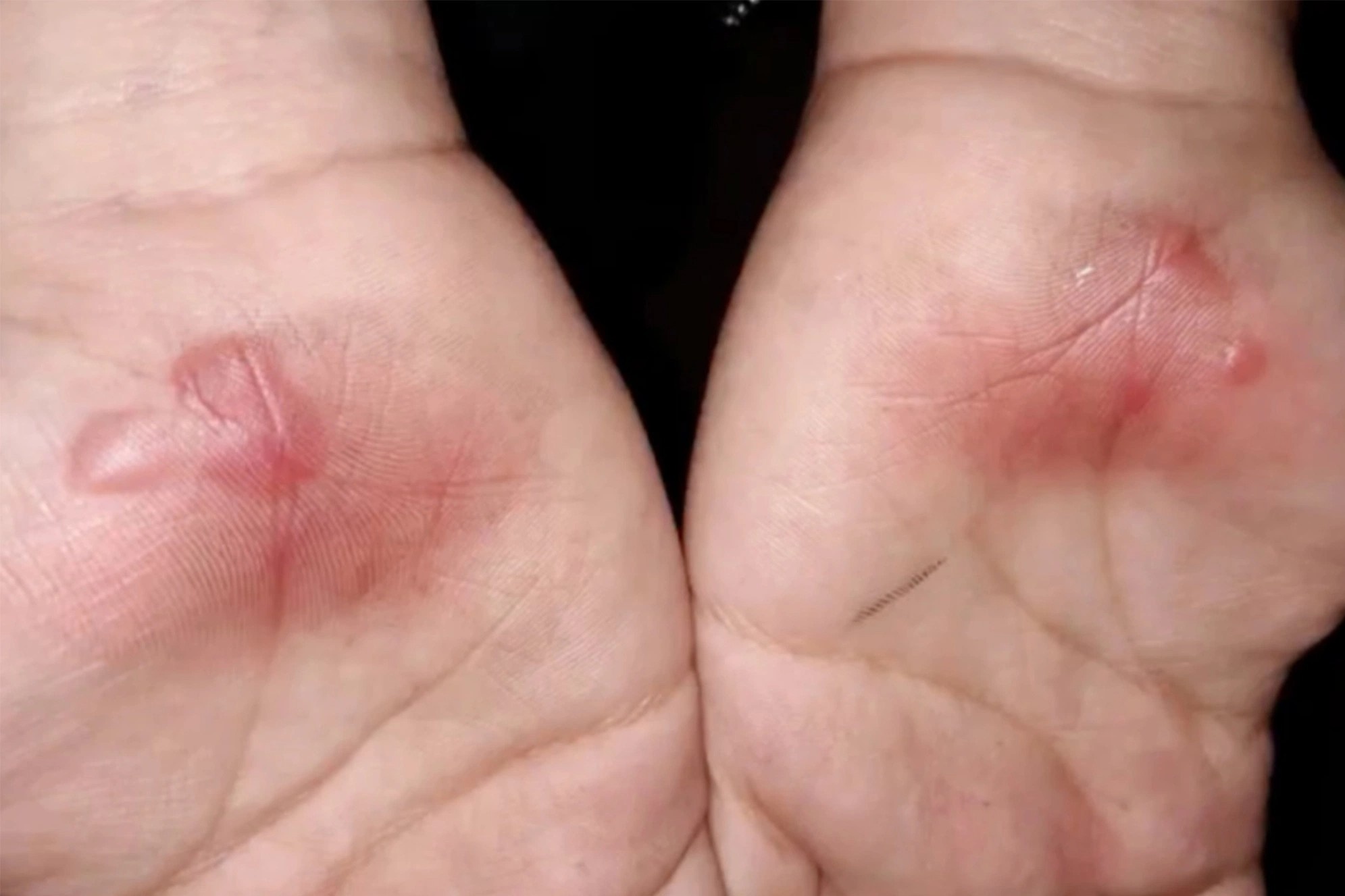 Hoc sinh o My bong tay vi bi phat bo giua troi nang 38 do C hinh anh