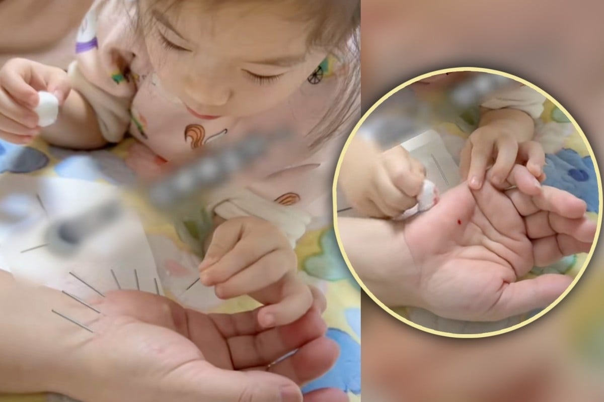 Be gai 5 tuoi gay choang voi ky thuat cham cuu dieu luyen hinh anh