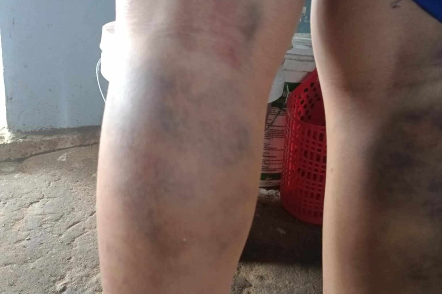 Danh hoc sinh bam tim 2 chan, co giao chu nhiem bi dinh chi cong tac hinh anh