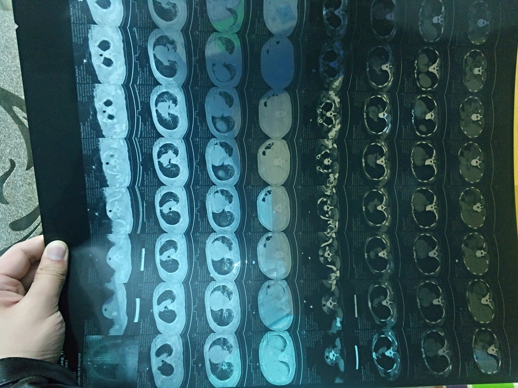 virus corona sieu lay lan anh 1