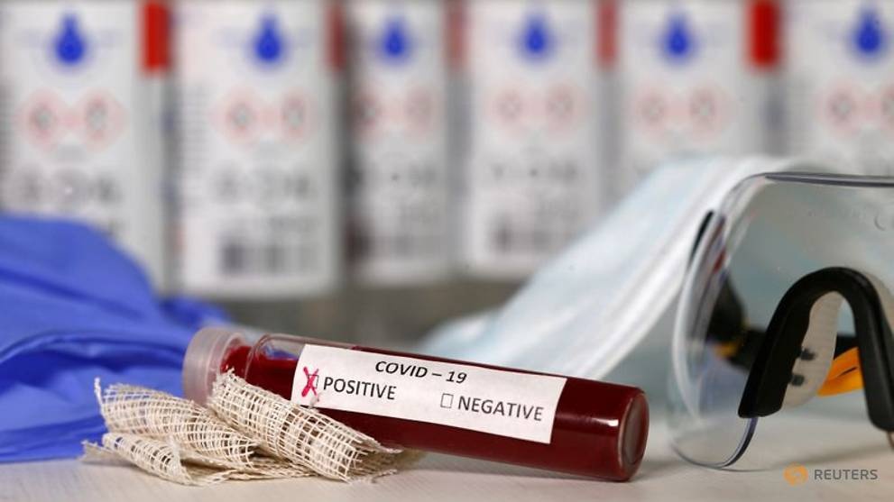 Nguoi dan ong Nhat 'phat tan' virus da tu vong hinh anh