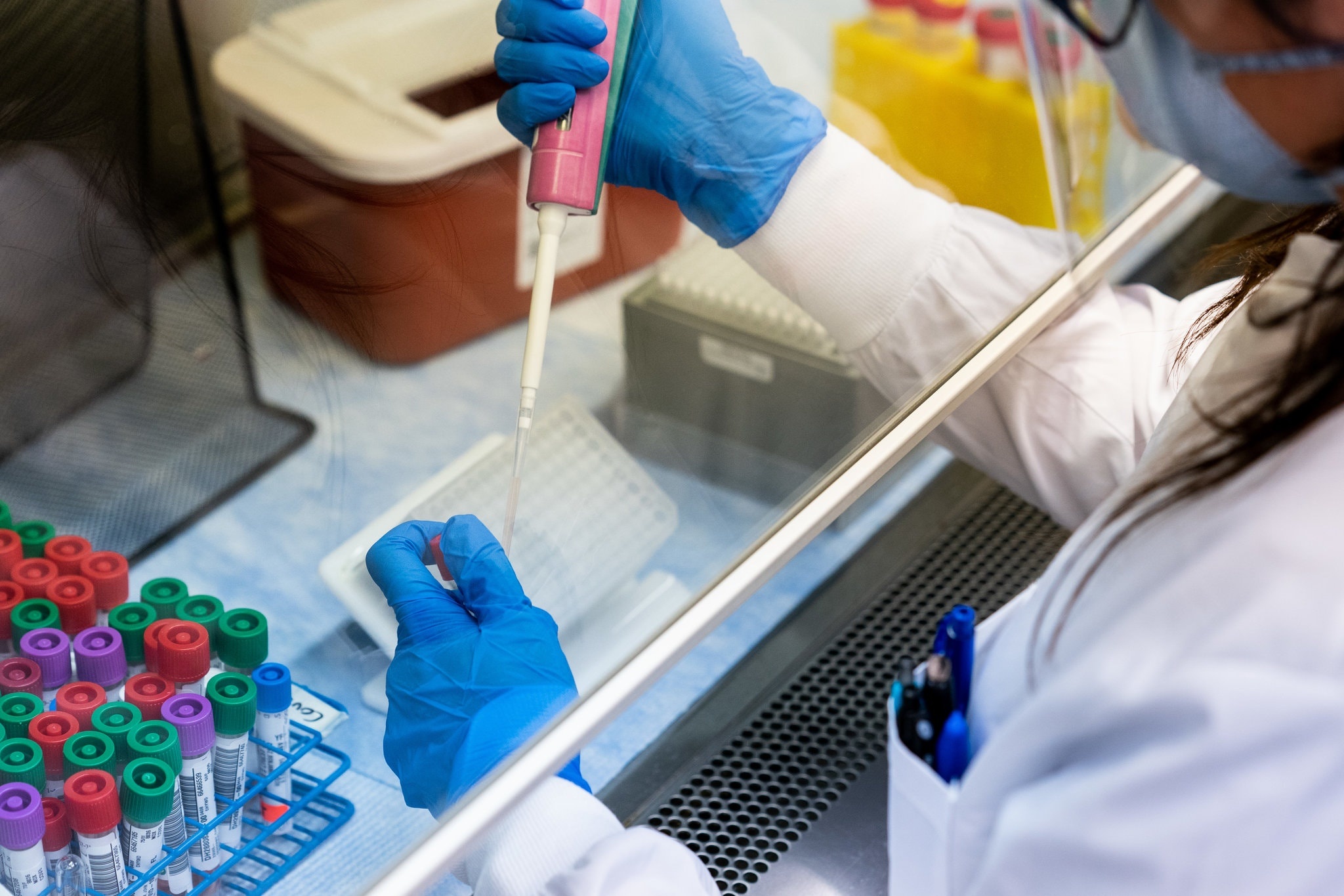 xet nghiem o My anh 11