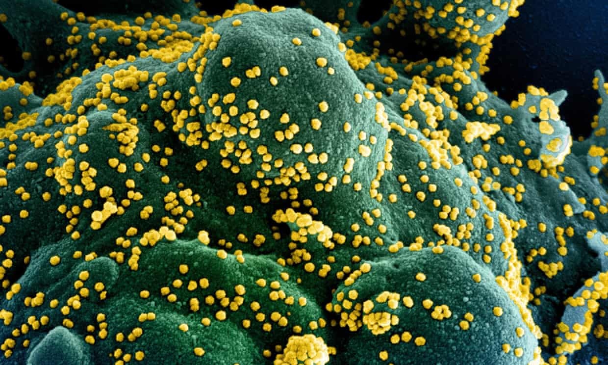 Trieu chung bat thuong o benh nhan Covid-19 khien bac si boi roi hinh anh