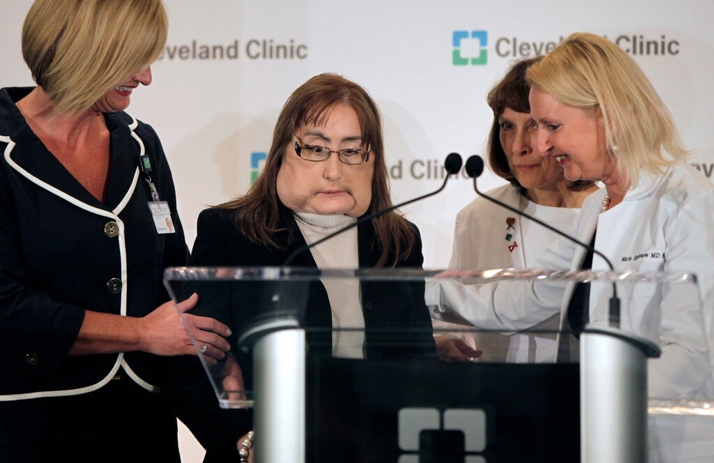 nguoi dau tien ghep mat o My qua doi anh 2