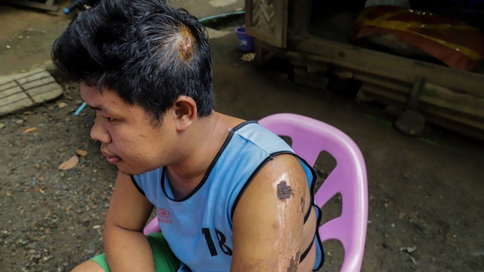 sap mo ngoc Myanmar anh 3