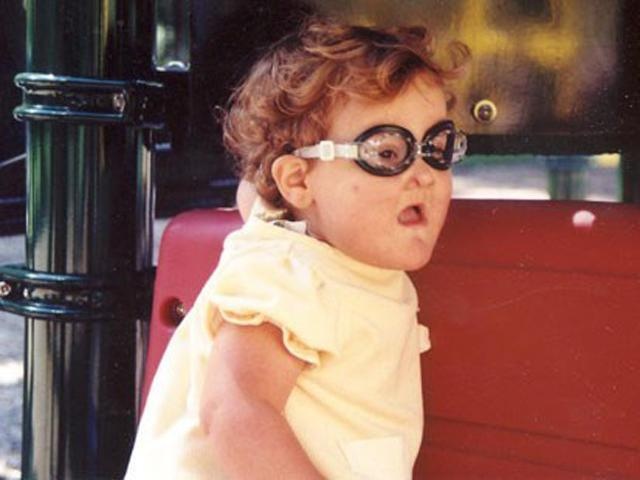 Hội chứng không biết đau ảnh 1 Hoi chung khong biet dau anh 1