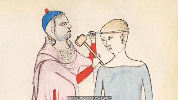 Ky thuat khoan hop so cua nguoi co dai - chua benh hay nghi le te than hinh anh