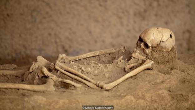 kỹ thuật khoan hộp sọ ảnh 1 ky thuat khoan hop so anh 1