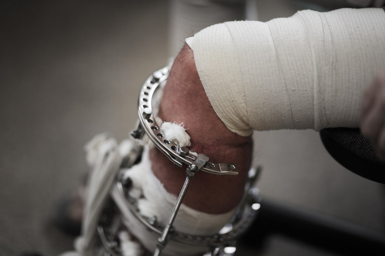 Nguoi tre Trung Quoc chap nhan cat xuong dui de thoat lun hinh anh