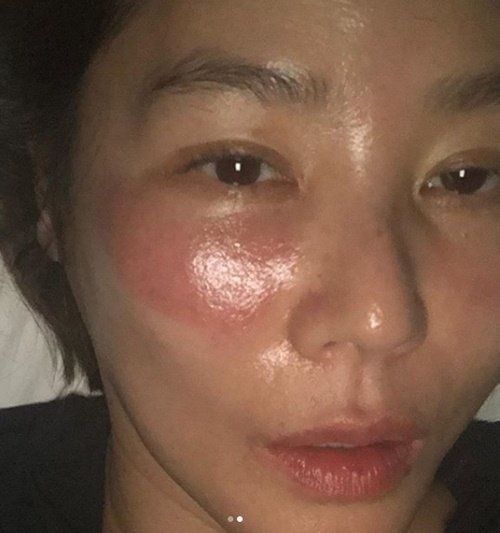 đắp mặt nạ sai cách ảnh 1 dap mat na sai cach anh 1